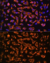 Anti-DAG1 antibody used in Immunocytochemistry/ Immunofluorescence (ICC/IF). GTX64471