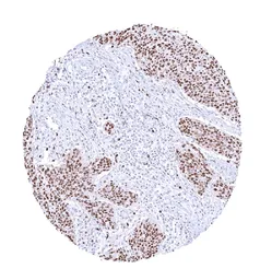 Anti-PCNA antibody [HMV4714] HistoMAX&trade; used in IHC (Paraffin sections) (IHC-P). GTX644715