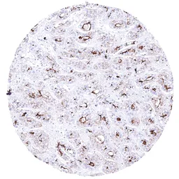 Anti-BSEP antibody [HMV4715] HistoMAX&trade; used in IHC (Paraffin sections) (IHC-P). GTX644716