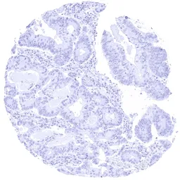 Anti-Opsin Red / Green antibody [HMV4716] HistoMAX&trade; used in IHC (Paraffin sections) (IHC-P). GTX644717
