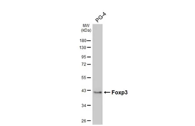 Anti-FOXP3 antibody [HL4717] used in Western Blot (WB). GTX644721