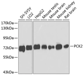 Anti-PCK2 antibody used in Western Blot (WB). GTX64476