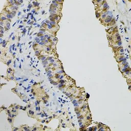 Anti-Dynamin 2 antibody used in IHC (Paraffin sections) (IHC-P). GTX64478
