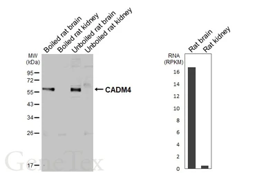 Anti-CADM4 antibody [GT272] used in Western Blot (WB). GTX644789