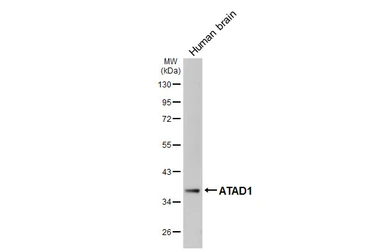 Anti-ATAD1 antibody [GT275] used in Western Blot (WB). GTX644790