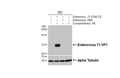 Anti-Enterovirus 71 VP1 antibody [HL4796] used in Western Blot (WB). GTX644808