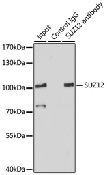 Anti-SUZ12 antibody used in Immunoprecipitation (IP). GTX64485