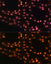 Anti-SUZ12 antibody used in Immunocytochemistry/ Immunofluorescence (ICC/IF). GTX64485