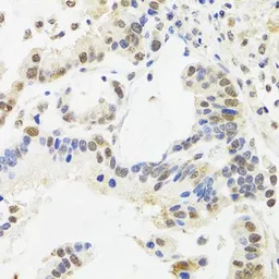Anti-SUZ12 antibody used in IHC (Paraffin sections) (IHC-P). GTX64485