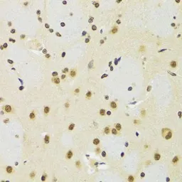 Anti-SUZ12 antibody used in IHC (Paraffin sections) (IHC-P). GTX64485
