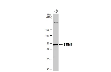 Anti-STIM1 antibody [HL4832] used in Western Blot (WB). GTX644895