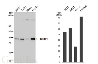 Anti-STIM1 antibody [HL4832] used in Western Blot (WB). GTX644895