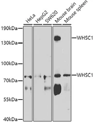Anti-NSD2 antibody used in Western Blot (WB). GTX64491