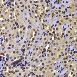 Anti-NSD2 antibody used in IHC (Paraffin sections) (IHC-P). GTX64491