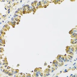 Anti-HRG antibody used in IHC (Paraffin sections) (IHC-P). GTX64492