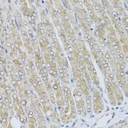 Anti-HRG antibody used in IHC (Paraffin sections) (IHC-P). GTX64492