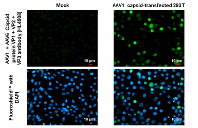 Anti-AAV1 + AAV6 Capsid protein VP1 + VP2 + VP3 antibody [HL4908] used in Immunocytochemistry/ Immunofluorescence (ICC/IF). GTX644973