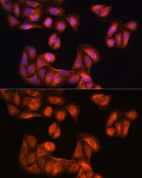 Anti-PHGDH antibody used in Immunocytochemistry/ Immunofluorescence (ICC/IF). GTX64499