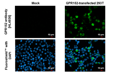 Anti-GPR152 antibody [HL4936] used in Immunocytochemistry/ Immunofluorescence (ICC/IF). GTX645009