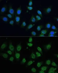 Anti-CPS1 antibody used in Immunocytochemistry/ Immunofluorescence (ICC/IF). GTX64501