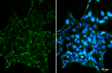 Anti-Amylin antibody [GT307] used in Immunocytochemistry/ Immunofluorescence (ICC/IF). GTX645033