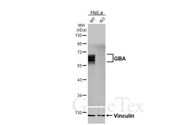 Anti-GBA antibody [HL4952] used in Western Blot (WB). GTX645038