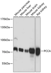 Anti-PCCA antibody used in Western Blot (WB). GTX64505