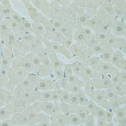 Anti-PHOX2B antibody used in IHC (Paraffin sections) (IHC-P). GTX64506