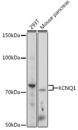 Anti-KCNQ1 antibody used in Western Blot (WB). GTX64507