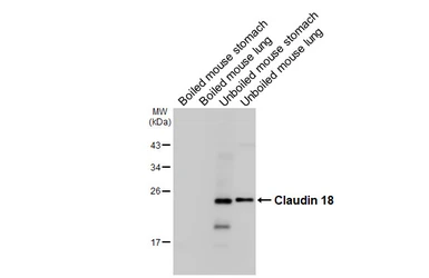 Anti-Claudin 18 antibody [HL5023] used in Western Blot (WB). GTX645116