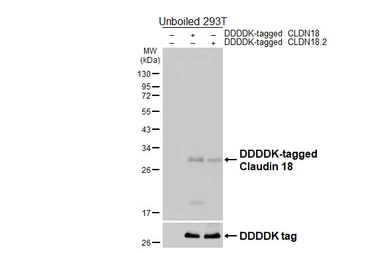 Anti-Claudin 18 antibody [HL5023] used in Western Blot (WB). GTX645116