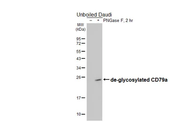 Anti-CD79a antibody [GT313] used in Western Blot (WB). GTX645188