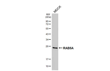 Anti-RAB5A antibody [GT318] used in Western Blot (WB). GTX645193