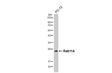Anti-Rab11A antibody [HL5043] used in Western Blot (WB). GTX645213