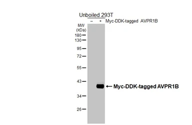 Anti-AVPR1B antibody [HL5060] used in Western Blot (WB). GTX645230