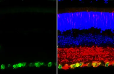 Anti-RBPMS antibody [HL3090-MS] used in IHC (Paraffin sections) (IHC-P). GTX645233