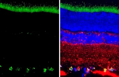 Anti-RBPMS antibody [HL3090-MS] used in IHC (Paraffin sections) (IHC-P). GTX645233