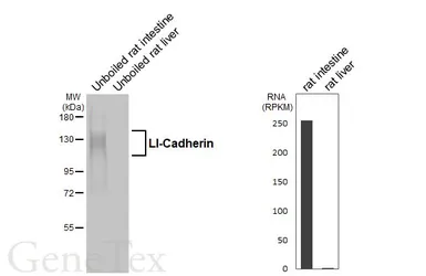 Anti-LI-Cadherin antibody [GT329] used in Western Blot (WB). GTX645249