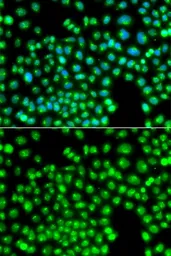 Anti-PIST antibody used in Immunocytochemistry/ Immunofluorescence (ICC/IF). GTX64526