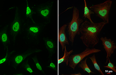 Anti-hnRNP A0 antibody [HL5089] used in Immunocytochemistry/ Immunofluorescence (ICC/IF). GTX645279