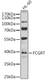 Anti-FCGRT antibody used in Western Blot (WB). GTX64528