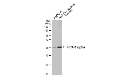 Anti-PPAR alpha antibody [HL5096] used in Western Blot (WB). GTX645290