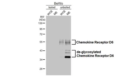 Anti-Chemokine Receptor D6 antibody [HL5104] used in Western Blot (WB). GTX645298