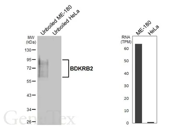 Anti-BDKRB2 antibody [HL5131] used in Western Blot (WB). GTX645327