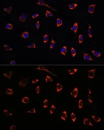 Anti-SHMT2 antibody used in Immunocytochemistry/ Immunofluorescence (ICC/IF). GTX64542