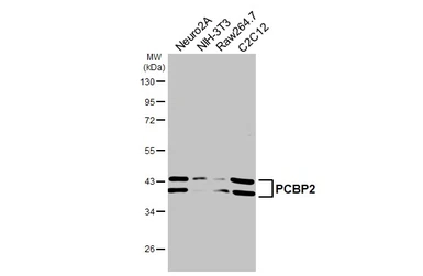 Anti-PCBP2 antibody [HL5177] used in Western Blot (WB). GTX645429