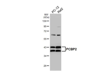Anti-PCBP2 antibody [HL5177] used in Western Blot (WB). GTX645429