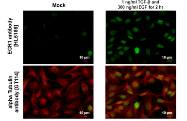 Anti-EGR1 antibody [HL5186] used in Immunocytochemistry/ Immunofluorescence (ICC/IF). GTX645438