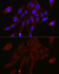 Anti-TMPRSS2 antibody used in Immunocytochemistry/ Immunofluorescence (ICC/IF). GTX64544