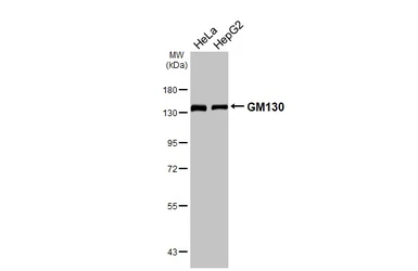 Anti-GM130 antibody [HL5191] used in Western Blot (WB). GTX645443
